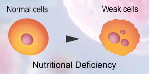 Nutritional Deficiency