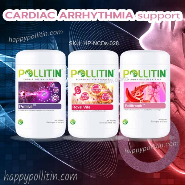 Cardiac Arrhythmia Support