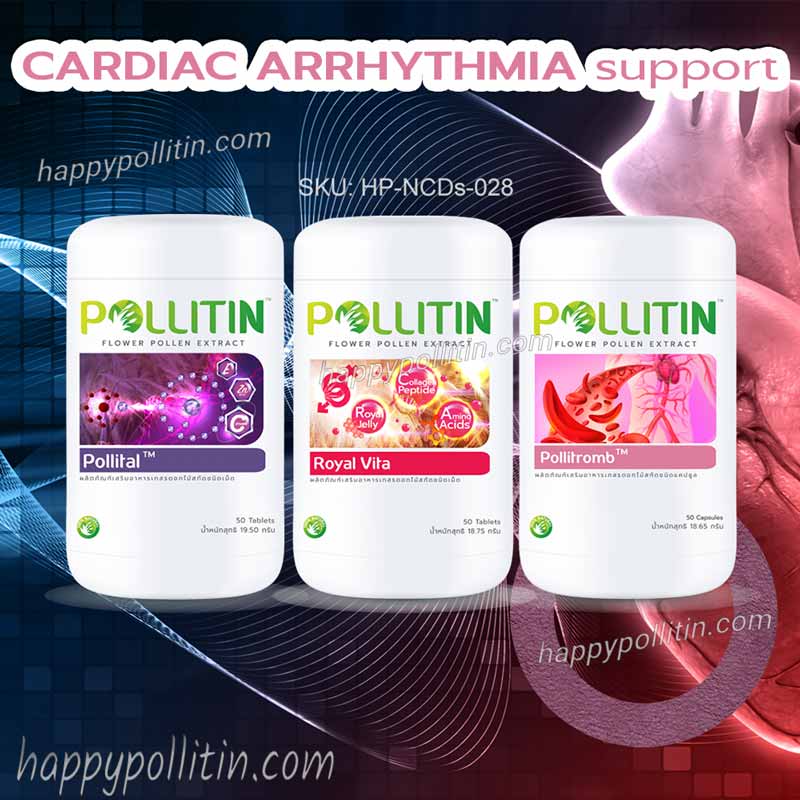 Cardiac Arrhythmia Support