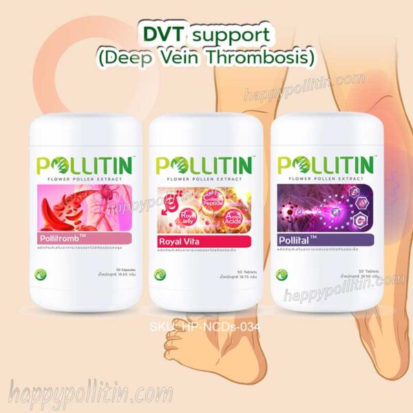 DVT Support