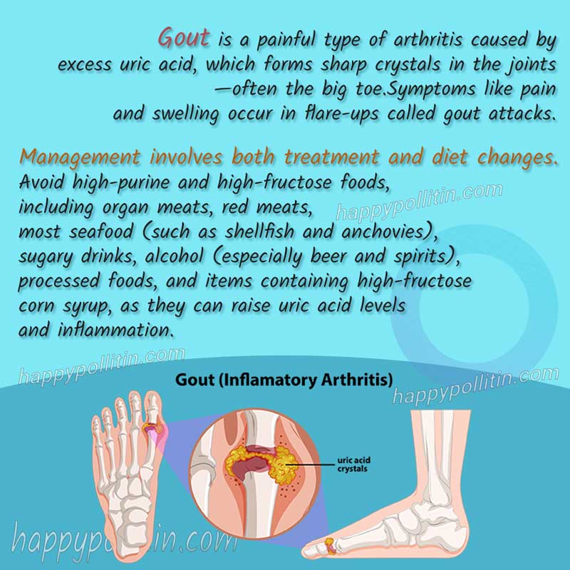 Gout inflamatory arthritis