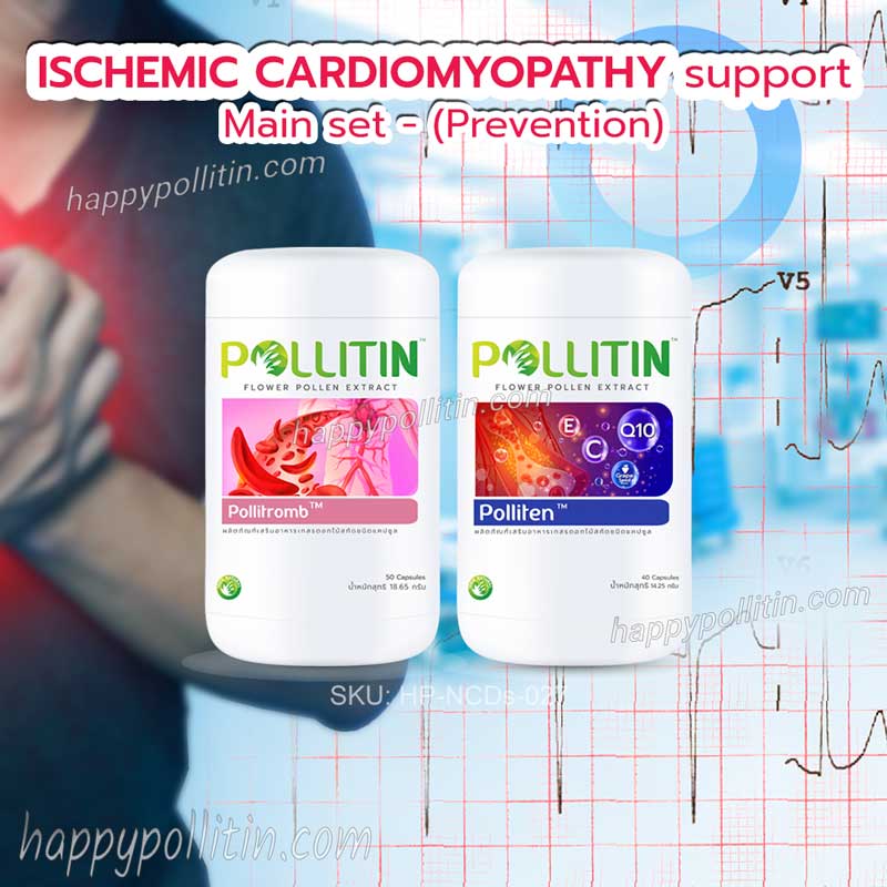 Ischemic Cardiomyopathy Support-Main