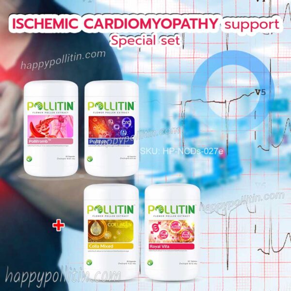 Ischemic Cardiomyopathy Support-special