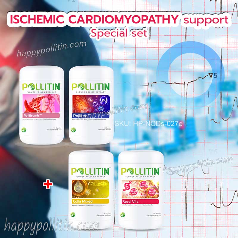 Ischemic Cardiomyopathy support-special