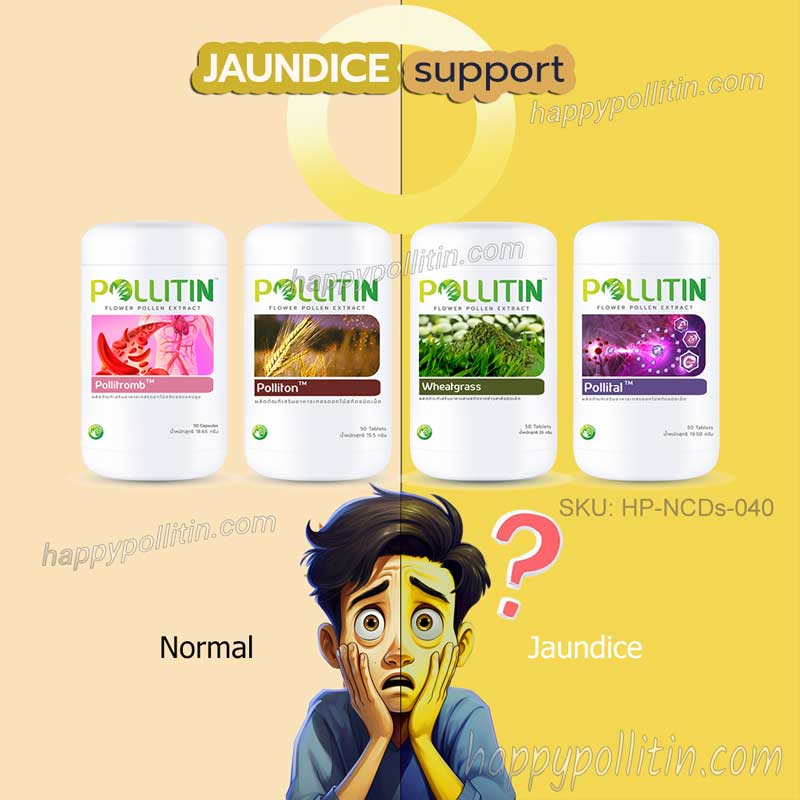 Jaundice Support