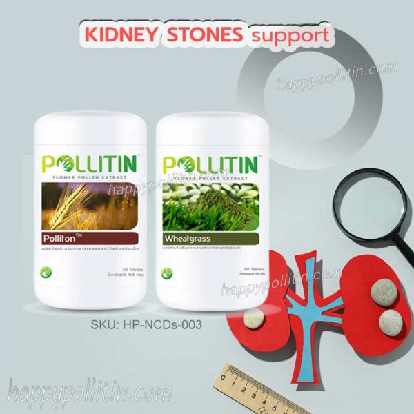 Kidney Stones Support