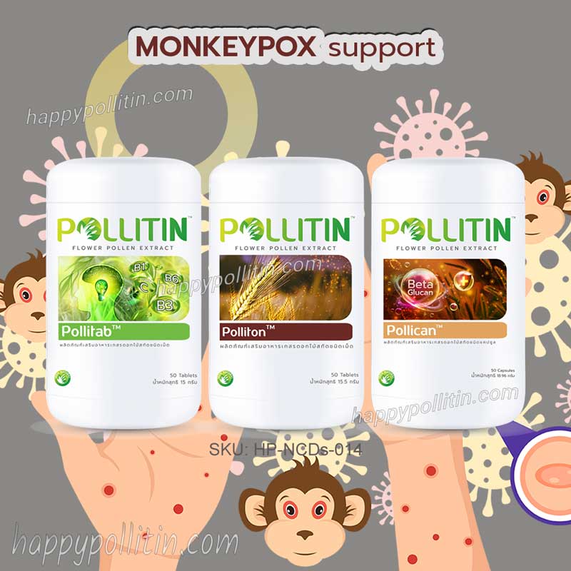 Monkeypox-Support